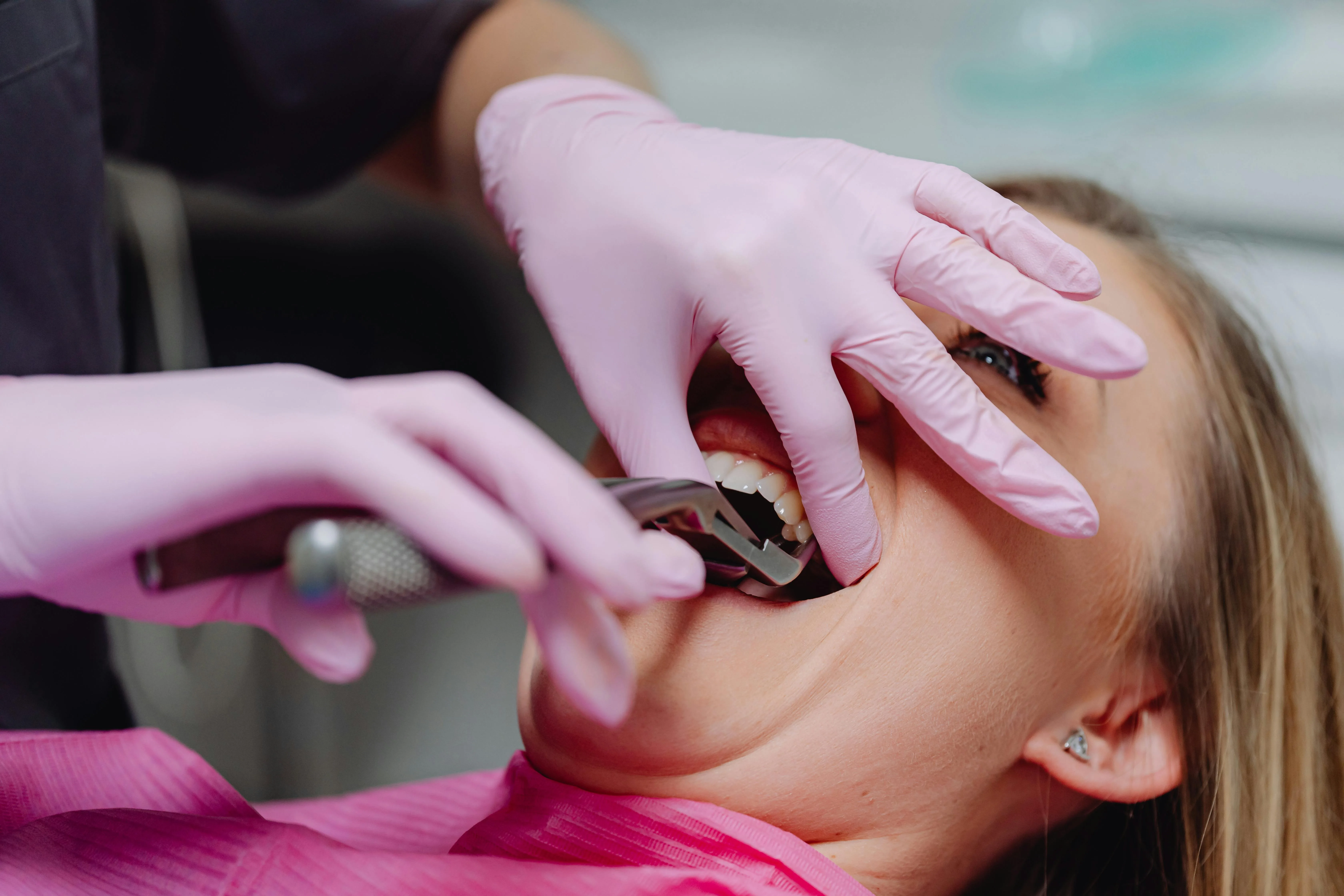 Tooth Removal and Oral Surgeries